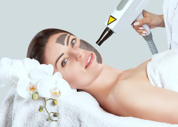 Acne Laser Treatment