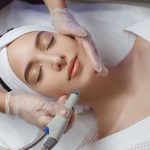 Laser Treatment for Acne