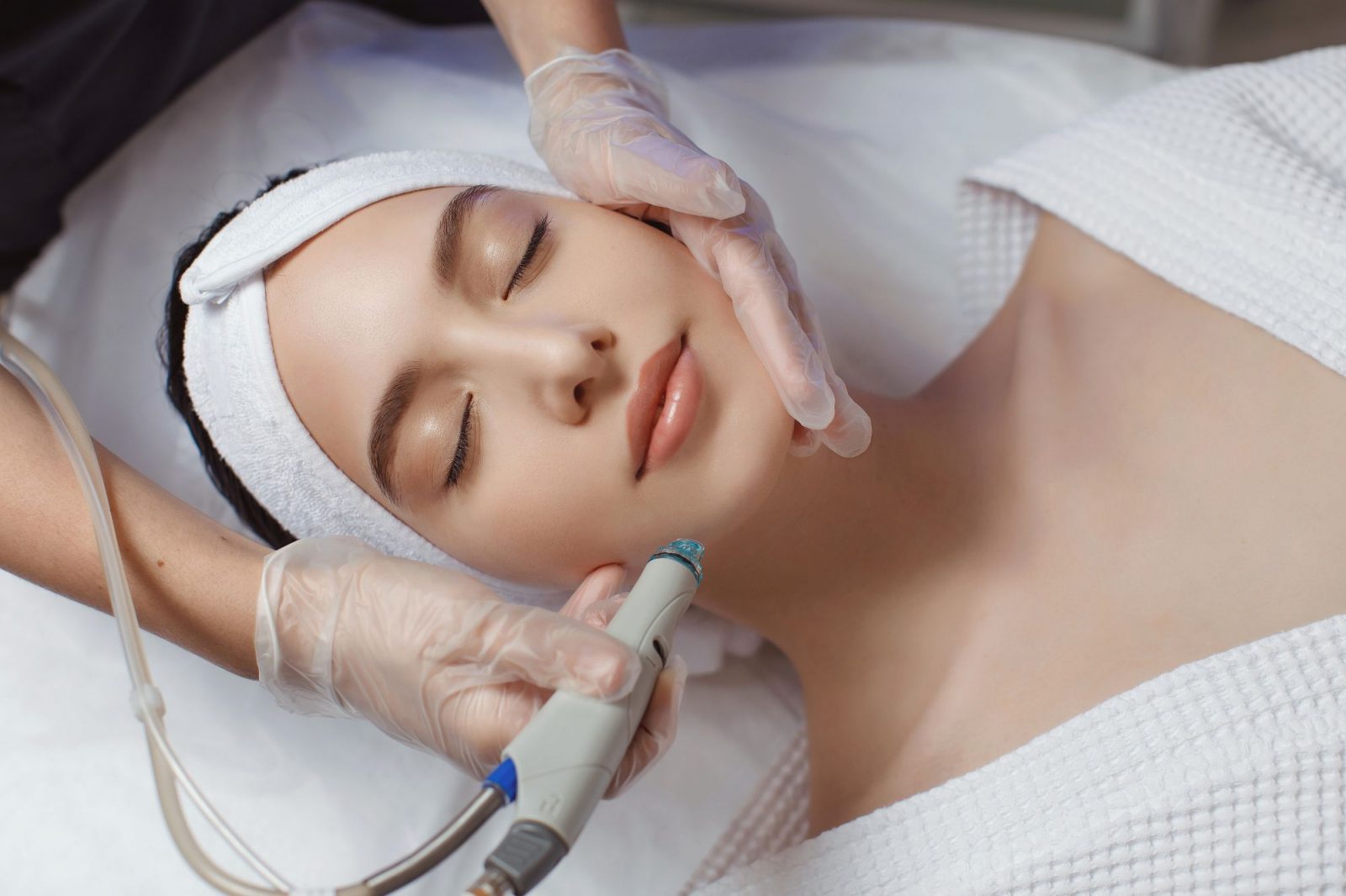 Laser Treatment for Acne