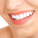 5 Tips to brighten smile